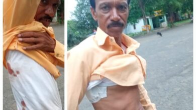 Photo of ऑर्डनेंस फैक्ट्री इटारसी में बंदर ने व्यापारी को किया घायल..