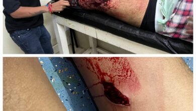 Photo of पुरानी इटारसी आजाद चौराहे के पास हुई चाकू बाजी की घटना.